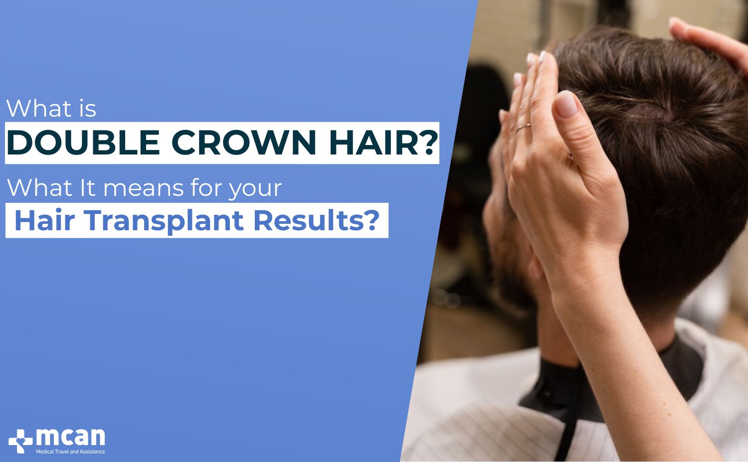What is Double Crown Hair What It Means for Your Hair Transplant Results Cover