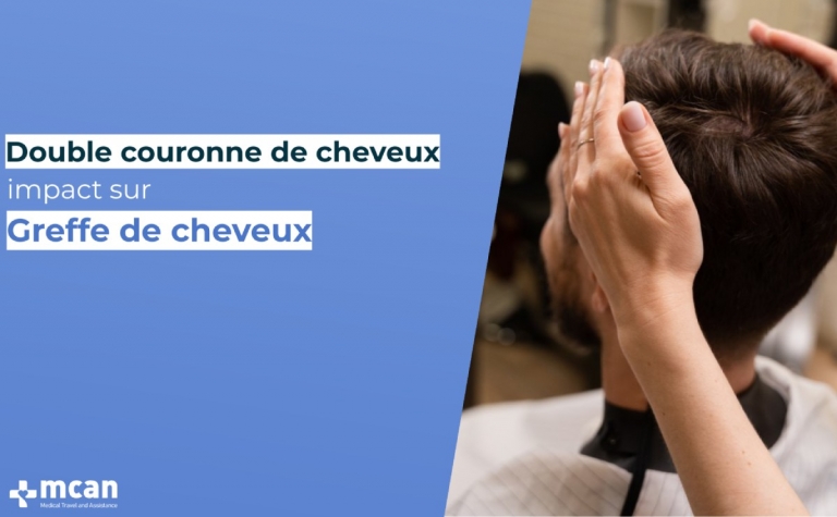 Double couronne de cheveux: impact sur Greffe de cheveux 4 double couronne de cheveux impact sur greffe de cheveux double-couronne-de-cheveux-impact-sur-greffe-de-cheveux