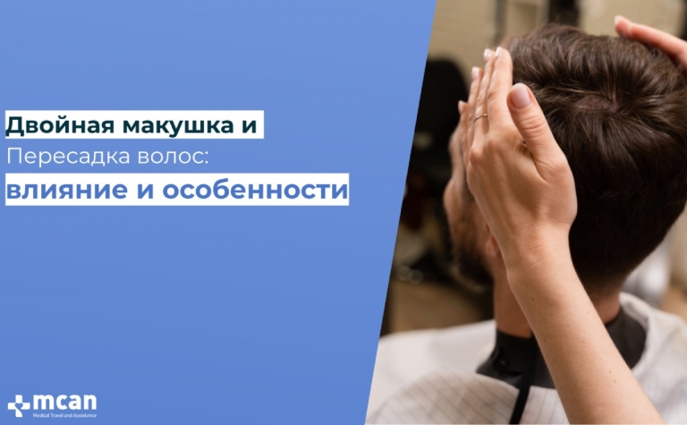 Двойная макушка и Пересадка волос: влияние и особенности 5 dvoinaya makushka i peresadka volos vliyaniye i osobennosti dvoinaya-makushka-i-peresadka-volos-vliyaniye-i-osobennosti