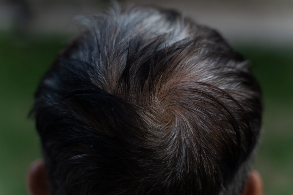 how can a double crown affect hair appearance