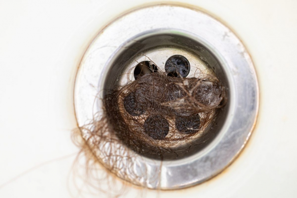 how much hair loss is normal in the shower