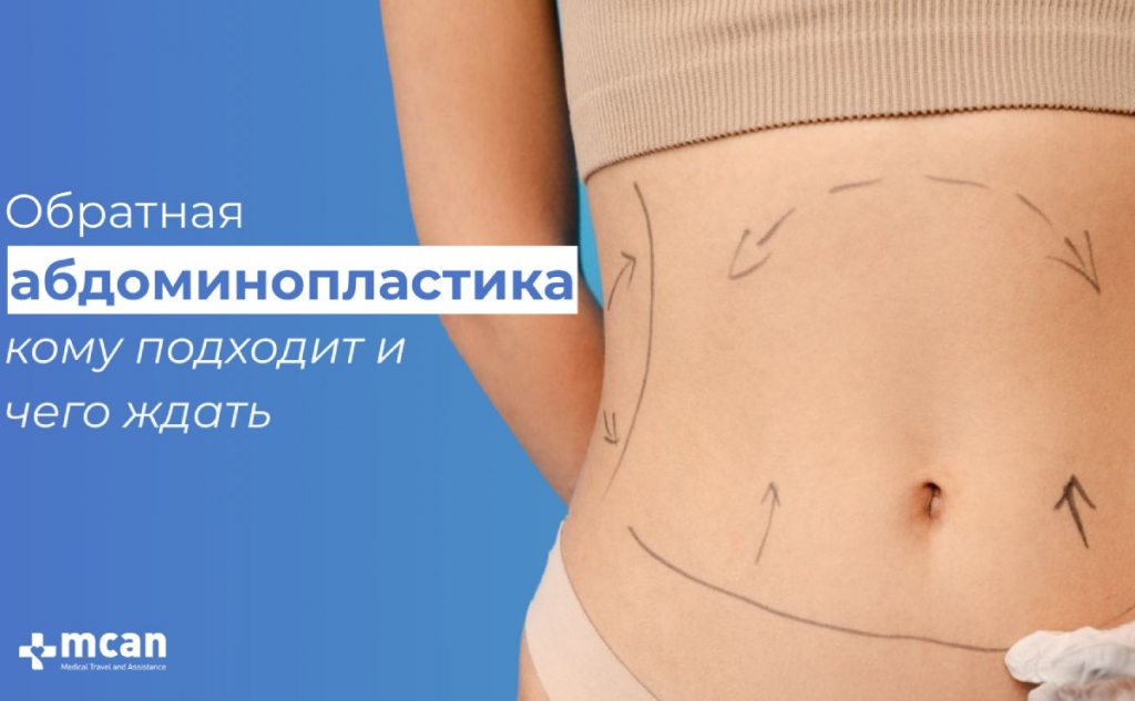 obratnaya-abdominoplastika-komu-podkhodit-i-chego-zhdat