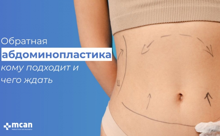 Обратная абдоминопластика — кому подходит и чего ждать 2 obratnaya abdominoplastika komu podkhodit i chego zhdat obratnaya-abdominoplastika-komu-podkhodit-i-chego-zhdat