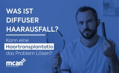 DE What Is Diffuse Thinning min