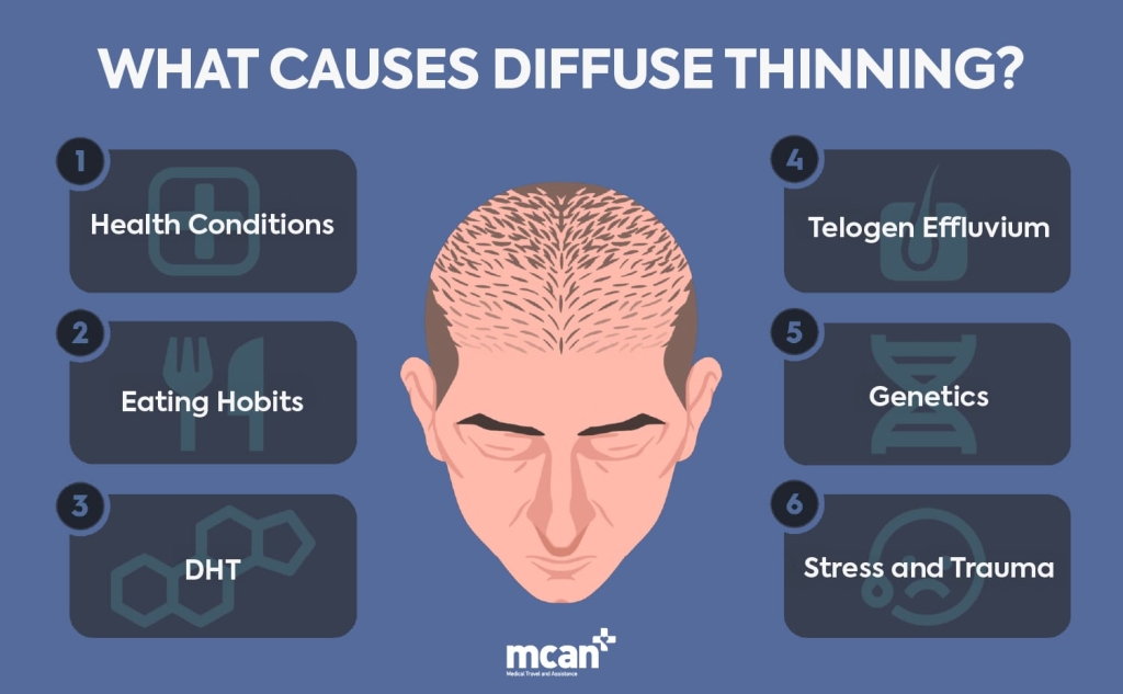 EN What Causes Diffuse Thinning min