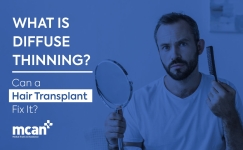 EN What Is Diffuse Thinning min