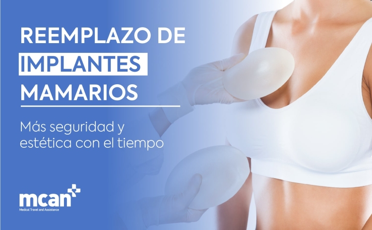 Recambio de implantes mamarios: más seguridad y estética con el tiempo 12 ES Breast Implant Replacement copy min 1 ES Breast Implant Replacement copy min 1
