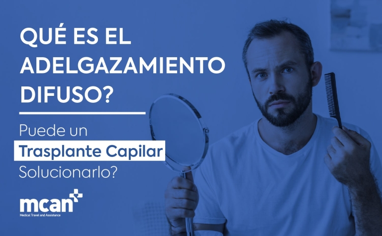 Trasplante capilar sin agujas 49 ES What Is Diffuse Thinning min ¿Qué es el adelgazamiento difuso? ¿Puede un trasplante capilar solucionarlo?