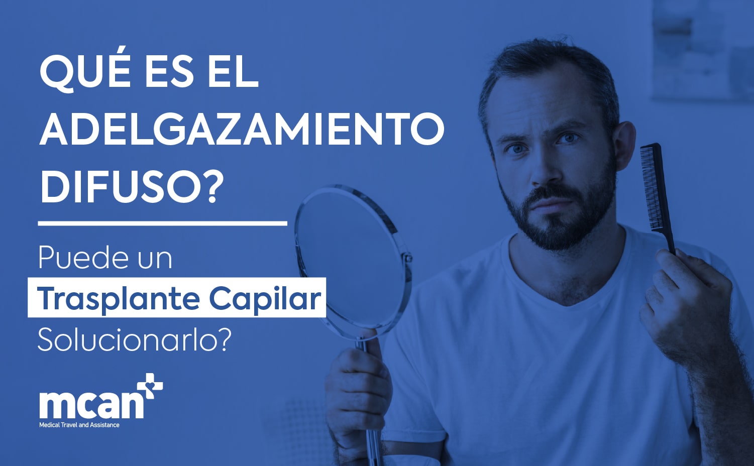 ¿Qué es el adelgazamiento difuso? ¿Puede un trasplante capilar solucionarlo? 1 ES What Is Diffuse Thinning min ES What Is Diffuse Thinning min