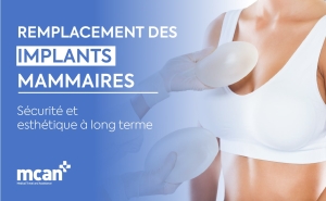 FR Breast Implant Replacement copy min 1