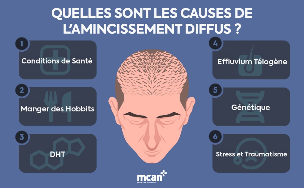Qu’est-ce que l’alopécie diffuse ? Une greffe de cheveux peut-elle y remédier ? 2 FR What Causes Diffuse Thinning min FR What Causes Diffuse Thinning min