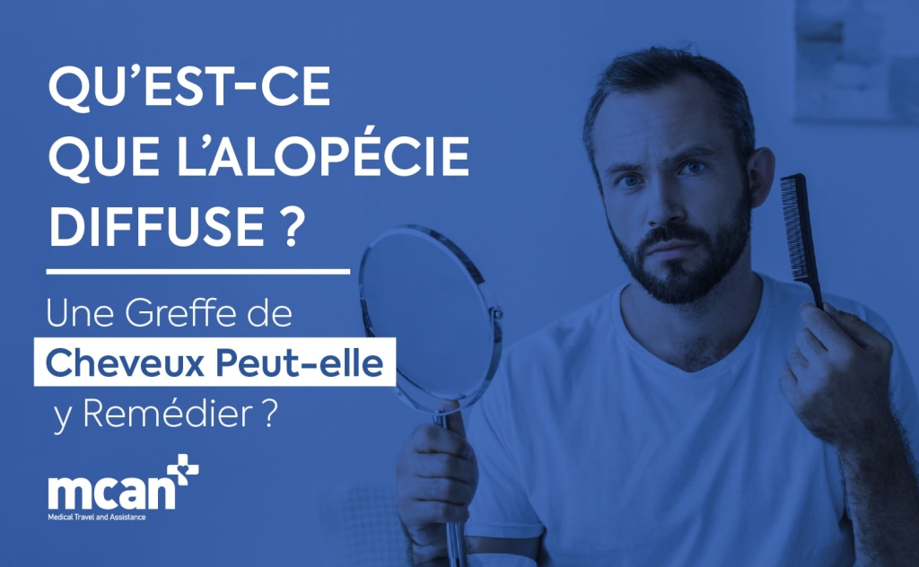 Qu’est-ce que l’alopécie diffuse ? Une greffe de cheveux peut-elle y remédier ? 1 FR What Is Diffuse Thinning min FR What Is Diffuse Thinning min