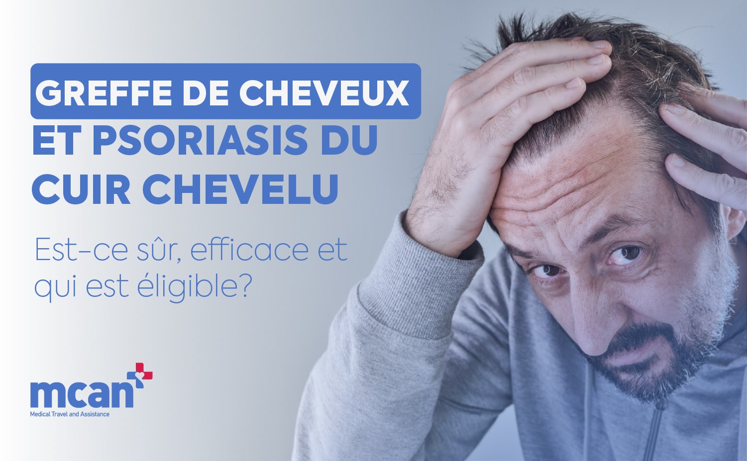 Greffe de cheveux et psoriasis du cuir chevelu Cover