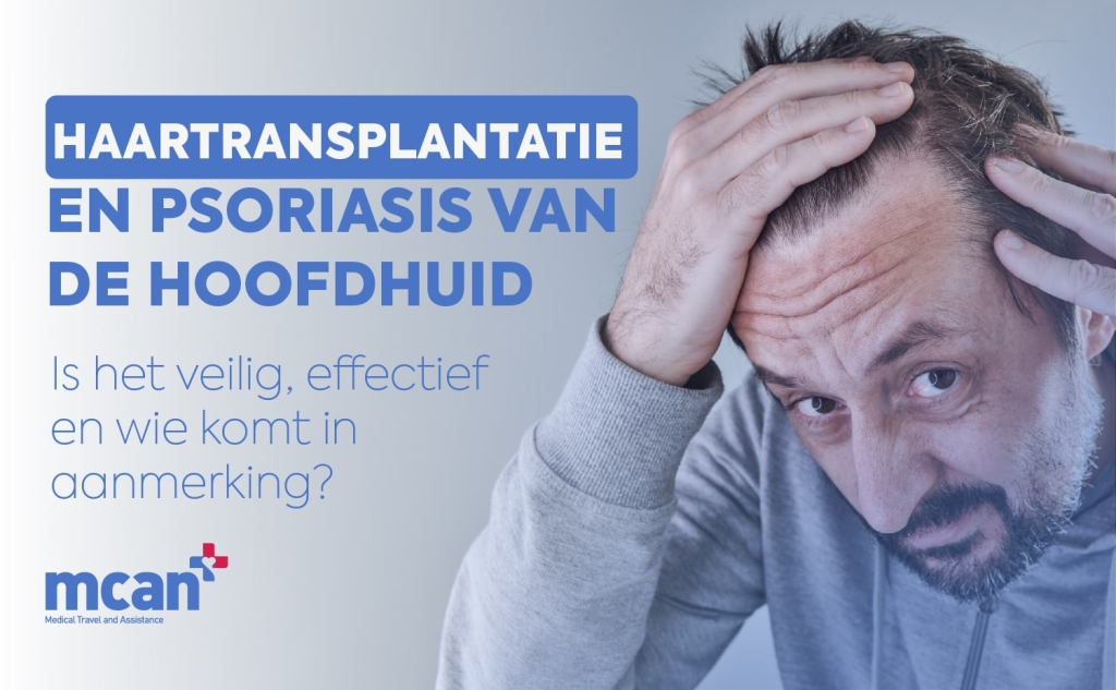 Haartransplantatie en psoriasis van de hoofdhuid Cover
