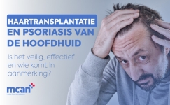 Haartransplantatie en psoriasis van de hoofdhuid Cover