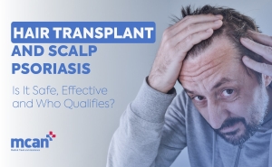Hair Transplant and Scalp Psoriasis: Is It Safe, Effective, and Who Qualifies? 3 Hair Transplant and Scalp Psoriasis Cover Hair Transplant and Scalp Psoriasis Cover