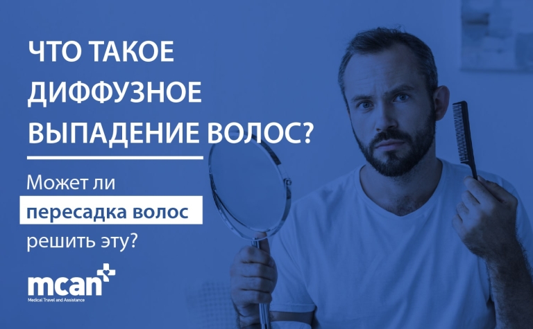 Что такое диффузное выпадение волос? Может ли пересадка волос решить эту проблему? 12 RU BWhat Is Diffuse Thinning min RU BWhat Is Diffuse Thinning min