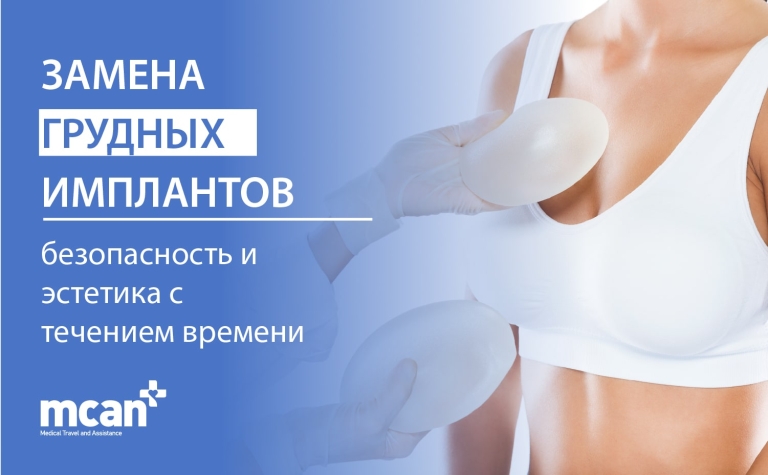 Замена грудных имплантов: безопасность и эстетика с течением времени 11 RU Breast Implant Replacement copy 3 min 1 RU Breast Implant Replacement copy 3 min 1