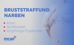 de Breast Lift Scars