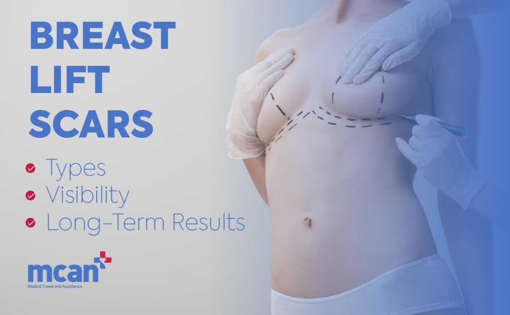 Breast Lift Scars: Types, Visibility, and Long-Term Results 1 en Breast Lift Scars min en Breast Lift Scars min