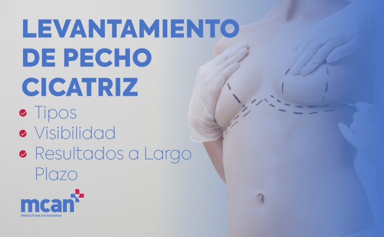 Levantamiento de pecho cicatriz: tipos, visibilidad y resultados a largo plazo 11 es Breast Lift Scars es Breast Lift Scars