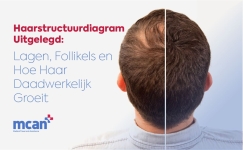 haarstructuurdiagram-uitgelegd-lagen-follikels-en-hoe-haar-daadwerkelijk-groeit
