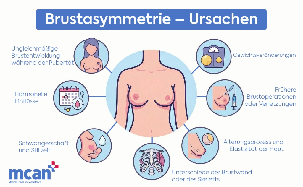 DE Causes of Breast Asymmetry