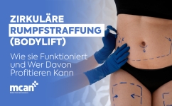 DE Circumferential Tummy Tuck Explained