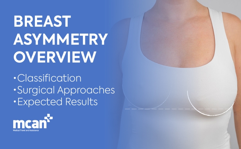 Breast Asymmetry Overview: Classification, Surgical Approaches, and Expected Results 9 EN Breast Asymmetry Overview EN Breast Asymmetry Overview