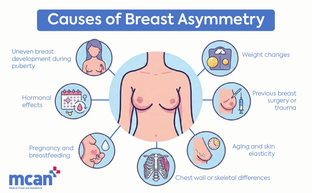 EN Causes of Breast Asymmetry