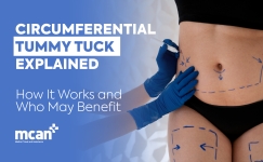 EN Circumferential Tummy Tuck Explained