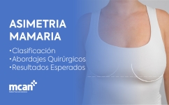 ES Breast Asymmetry Overview