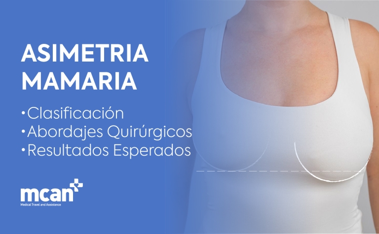 Asimetria mamaria: clasificación, abordajes quirúrgicos y resultados esperados 3 ES Breast Asymmetry Overview ES Breast Asymmetry Overview