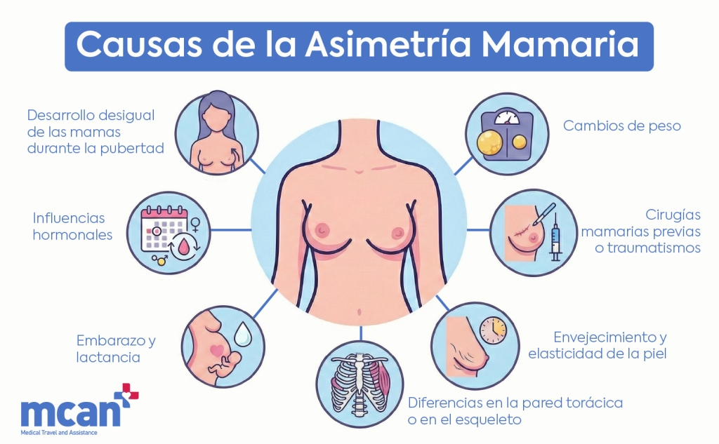 ES Causes of Breast Asymmetry