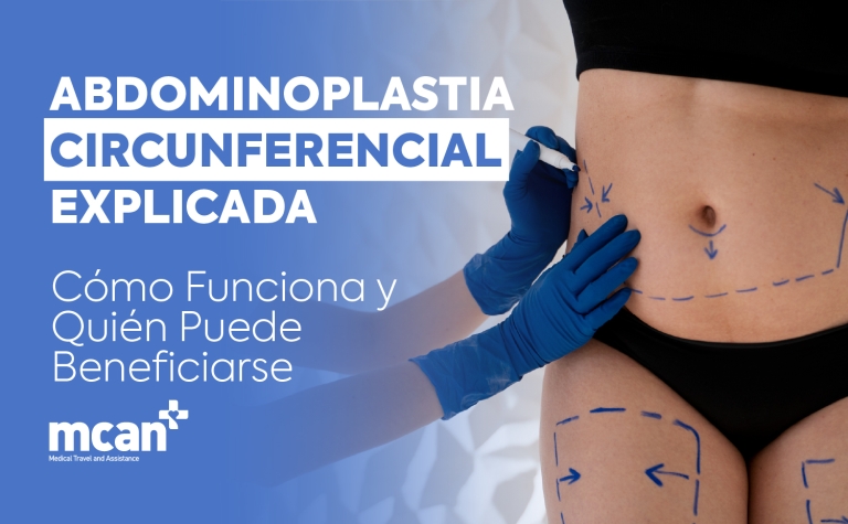 Abdominoplastia circunferencial explicada: cómo funciona y quién puede beneficiarse 5 ES Circumferential Tummy Tuck Explained ES Circumferential Tummy Tuck Explained