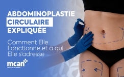 FR Circumferential Tummy Tuck Explained