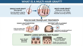 Multi Hair Graft