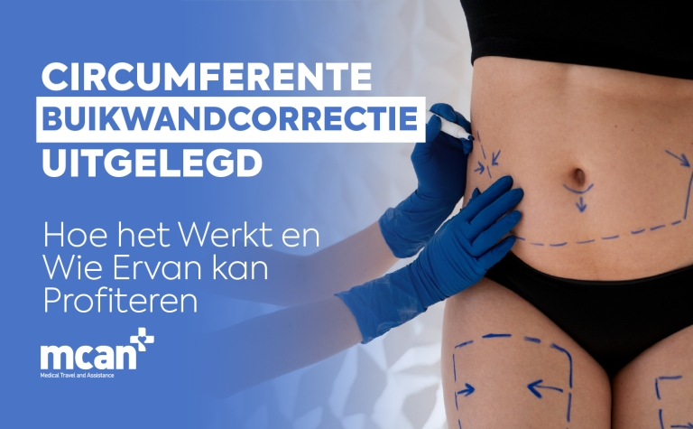 Circumferente buikwandcorrectie uitgelegd: hoe het werkt en wie ervan kan profiteren 11 NL Circumferential Tummy Tuck Explained NL Circumferential Tummy Tuck Explained
