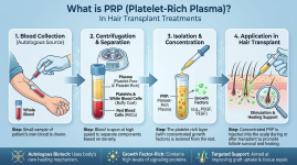 PRP Platelet Rich Plasma