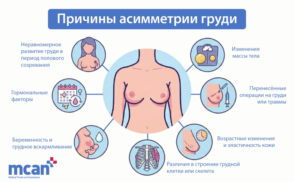 RU Causes of Breast Asymmetry