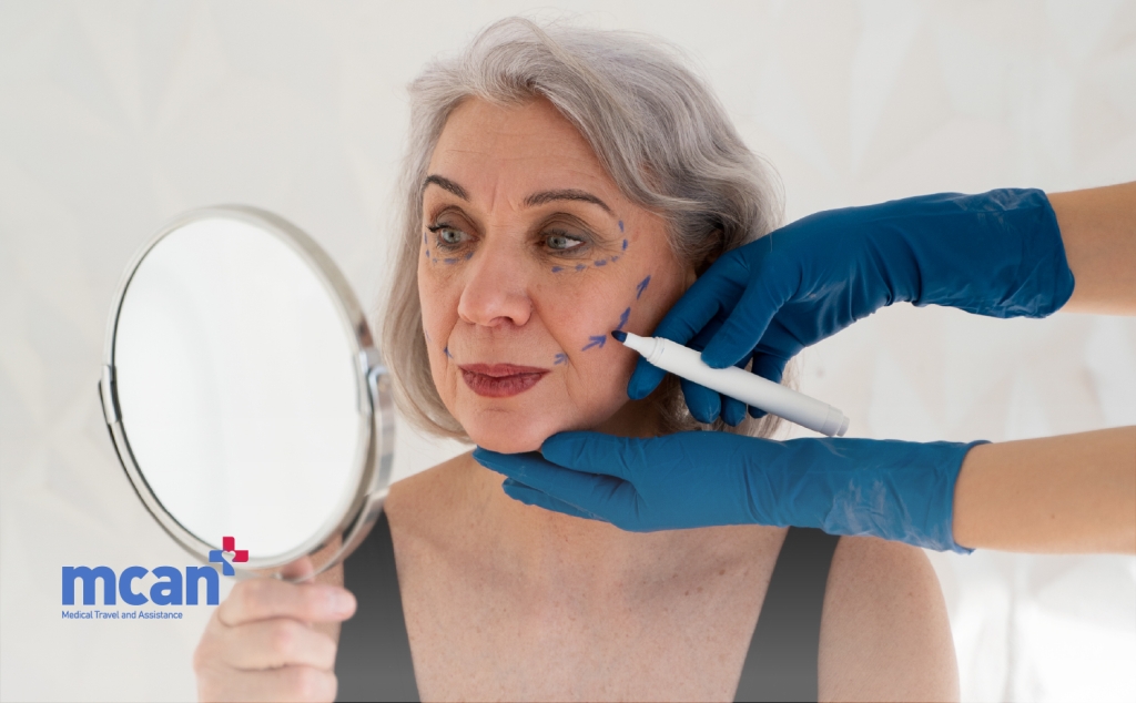 Why Might a Facelift Revision Be Needed