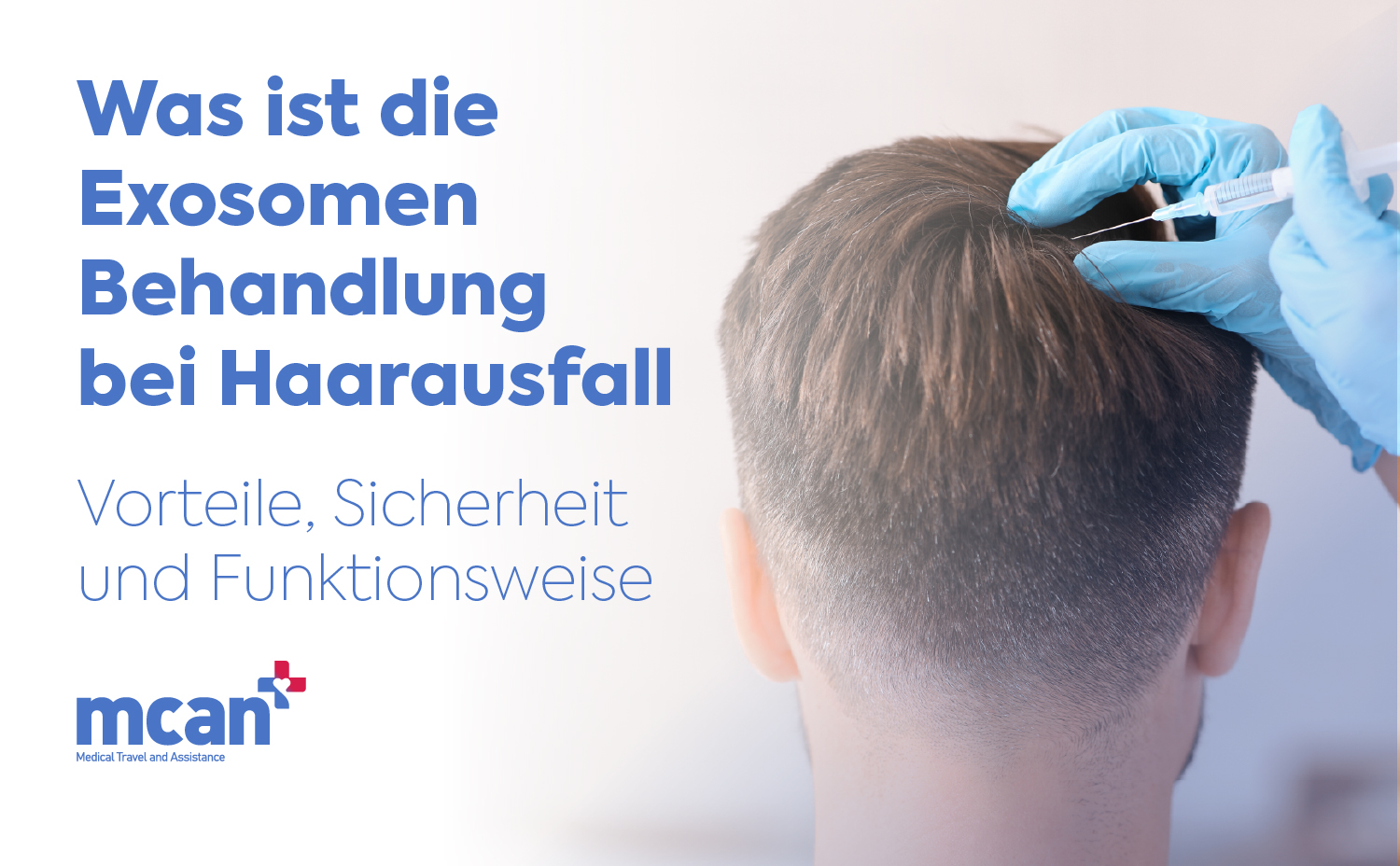 de What Is Exosome Hair Treatment