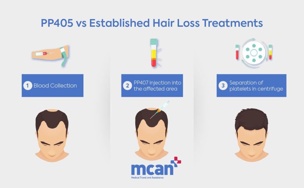 en PP405 vs Established Hair Loss Treatments