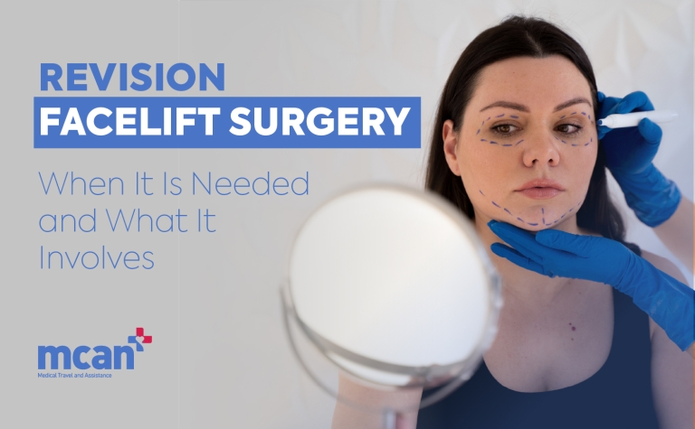 Facelift in Turkey 85 en Revision Facelift Surgery Revision Facelift Surgery: When It Is Needed and What It Involves