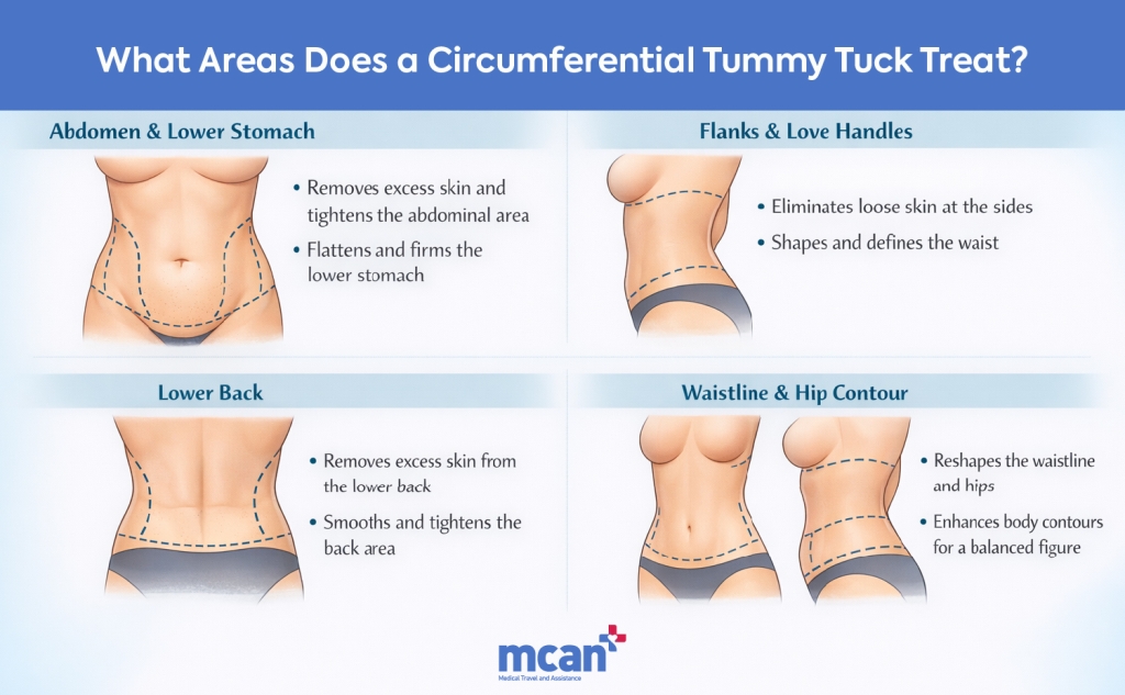 en What Areas Does a Circumferential Tummy Tuck Treat