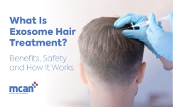 en What Is Exosome Hair Treatment