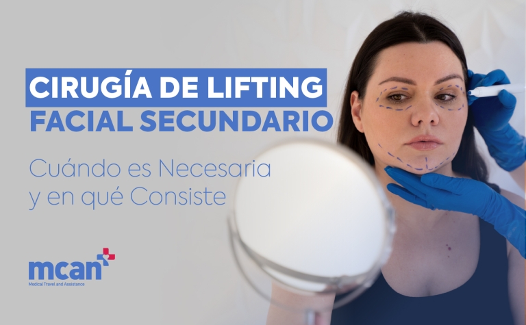 Cirugía de lifting facial secundario: cuándo es necesaria y en qué consiste 6 es Revision Facelift Surgery es Revision Facelift Surgery