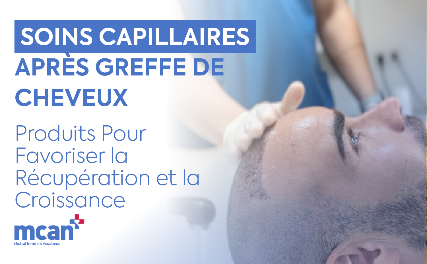 fr Hair Care After Hair Transplant