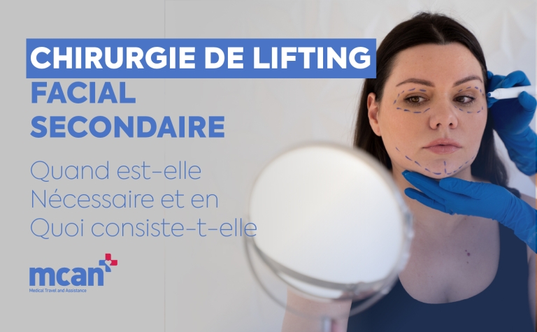 Chirurgie de lifting facial secondaire : quand est-elle nécessaire et en quoi consiste-t-elle 11 fr Revision Facelift Surgery fr Revision Facelift Surgery