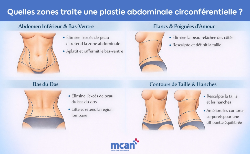 Abdominoplastie circulaire expliquée : comment elle fonctionne et à qui elle s’adresse 2 fr What Areas Does a Circumferential Tummy Tuck Treat fr What Areas Does a Circumferential Tummy Tuck Treat
